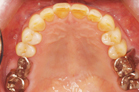 寿年の部１位の歯